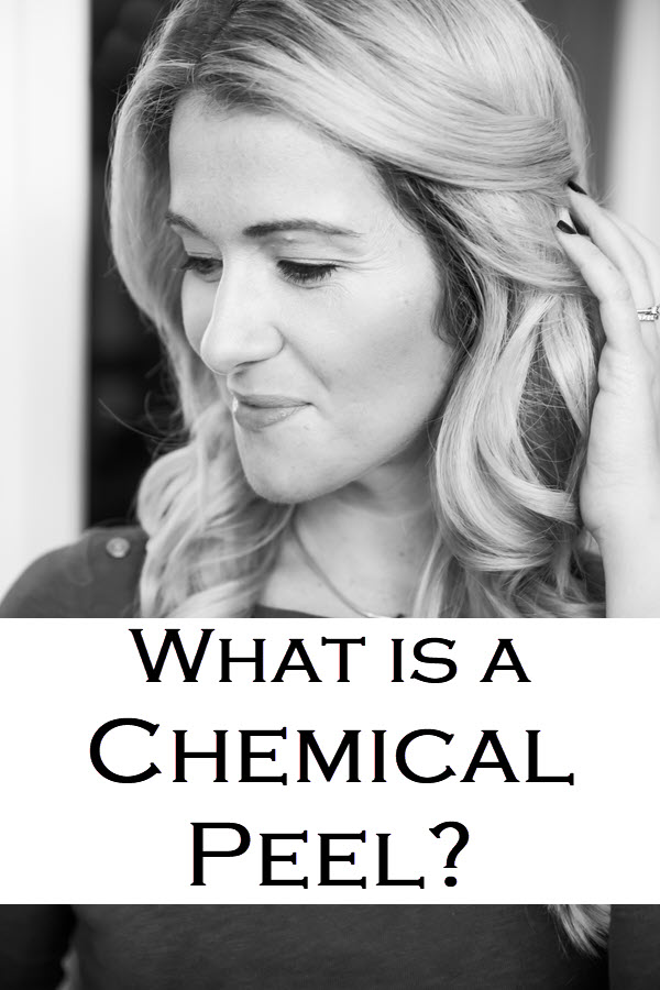 What is a Chemical Peel? Wondering what to Expect after Chemical Peel? Here is what to do before a chemical peel and what skincare to use after a peel. Answering question like can you wear makeup after a peel and how often should you get peels. #skincare