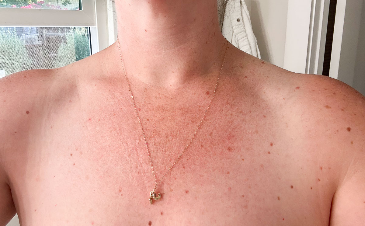 Crunchi Body Treatment Review