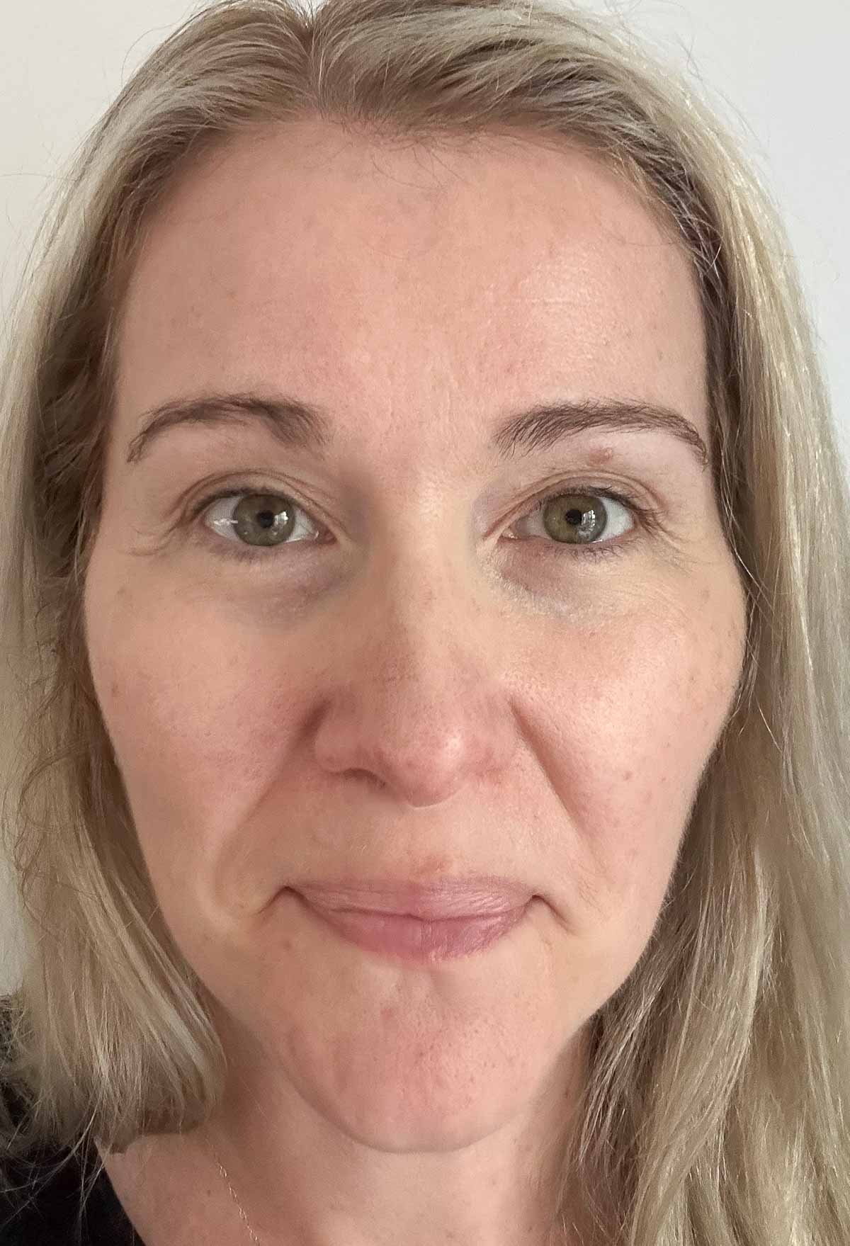 light vs medium coverage for concealers